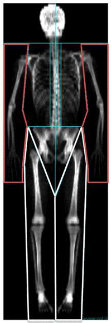 Representative Image Of A Dual Energy X Ray Absorptiometry Scan With
