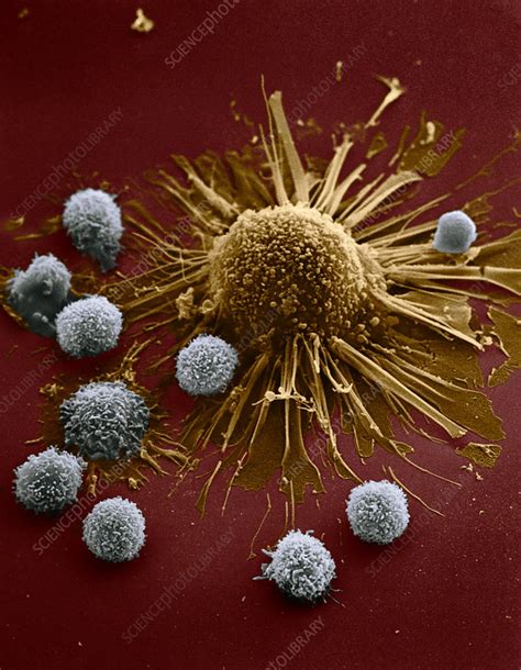 T Lymphocytes Attacking Cancer Cell Sem Stock Image C0518109