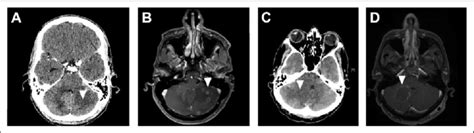 Contrast Enhanced Computed Tomography Ct Scan And Magnetic Resonance