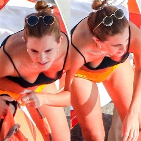 Emma Watson Topless Nude Sunbathing Photos Published In France Xgossipx