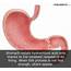 12 Interesting Stomach Facts Human Body  RaiseYourBrain