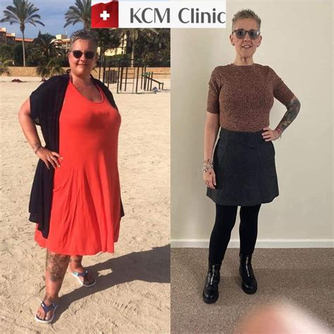 Kcm Clinic Weight Loss Surgery In Jelenia Gora Poland Clinichunter Com