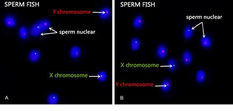 figure 1 from sperm processing affected ratio of x and y bearing sperm semantic scholar