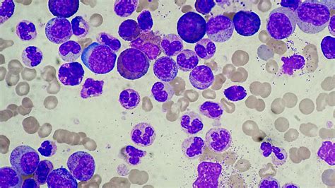 Leucócitos Parte 01 Os dois grupos de Glóbulos Brancos do Sangue