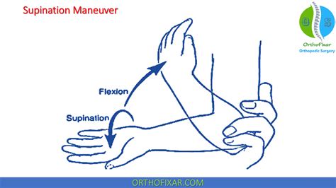 Nursemaid Elbow Reduction 2023 Orthofixar