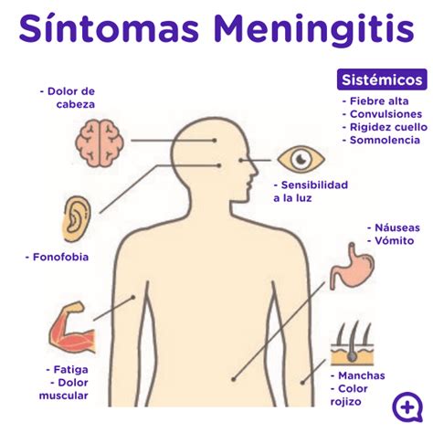 Meningitis origen vírico u origen bacteriano mediQuo