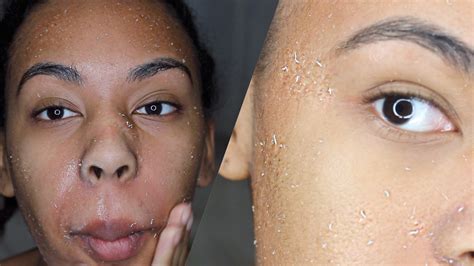 Glamour In Remove Dry Patches On Face