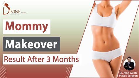 Mommy Makeover Surgery Mommy Makeover Procedure Result After 3 Months
