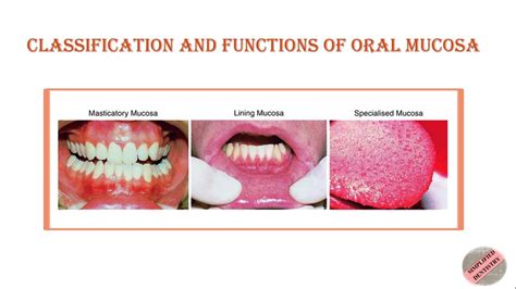 Classification And Functions Of Oral Mucosa Oral Mucous Membrane