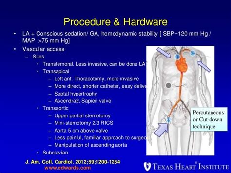 Tavi Procedure Review With Cases