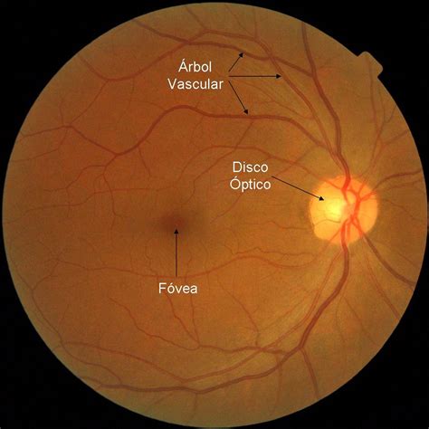 Un método automático detecta el estado del disco óptico en la retina