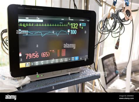 Electrocardiograph Ecg Or Ekg Unit In A Hospital Emergency Room