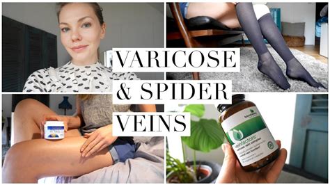 Spider Veins Treatment At Home Youtube