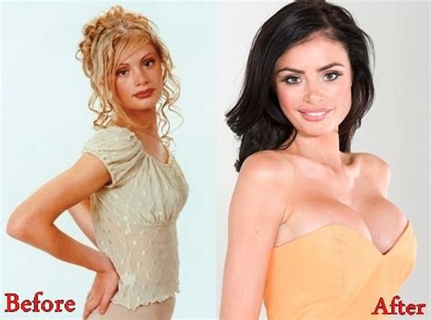 Chloe Sims Breasts Implants Plastic Surgery Before And After Photos Plastic Surgery
