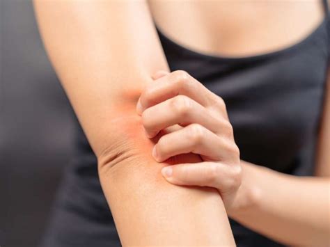 Itchy Elbows Causes Symptoms Rash Bumps Treatments And Home
