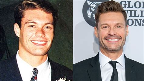 Ryan Seacrest S Plastic Surgery Has The Television Show Host Had Cosmetic Surgery The Media