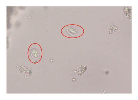 Giardia Lamblia Cyst Under Microscope Bruin Blog
