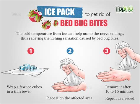 How To Get Rid Of Bed Bug Bites Top 10 Home Remedies