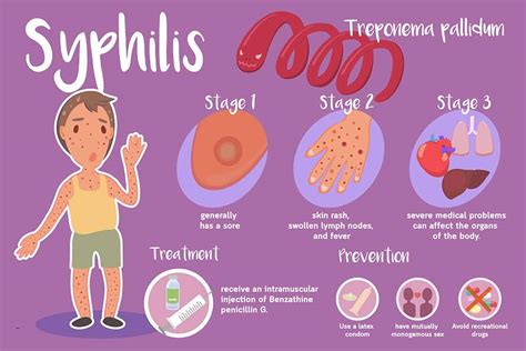 This chancre appears about 10 to 90 days after infection, most commonly around 3 weeks after a person has become infected with the syphilis bacteria ( treponema pallidum ). The Stages of Syphilis and Corresponding Symptoms - Page ...