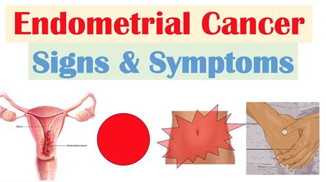 Endometrial Cancer Signs And Symptoms And Why They Occur Youtube