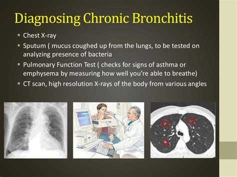 Chronic Bronchitis And Emphysema