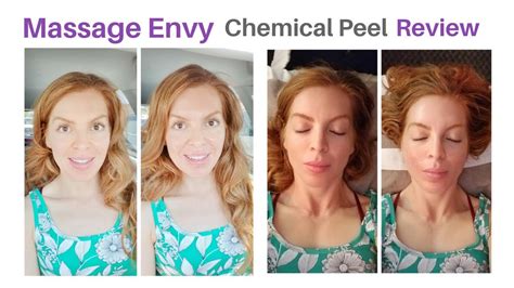Massage Envy Facials Chemical Peel Review Youtube
