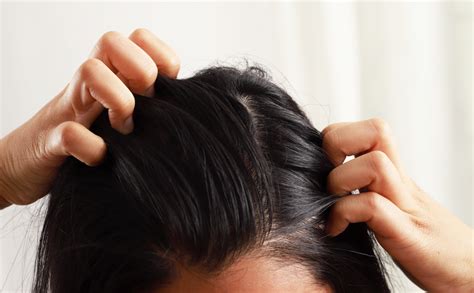 How To Treat And Prevent Scalp Acne Advanced Dermatology Care