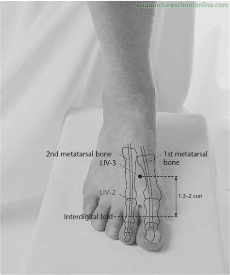 Acupuncture was found to improve plantar heel pain through various pathways. Foot Pain - Plantar Fasciitis
