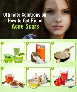 How To Get Rid Of Acne Scars With Top Ultimate Solutions