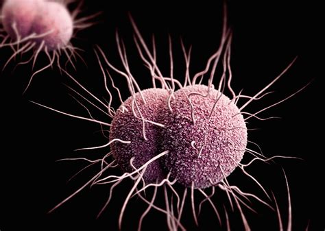 Gonorrhea Symptoms And Treatment Live Science
