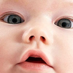 Maybe you would like to learn more about one of these? Eye & Vision Problems in Babies - Parents.com