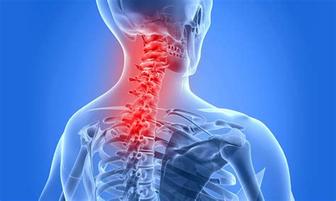 Men mostly affected by Ankylosing Spondylitis - News Today ...