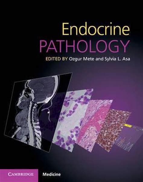 Endocrine Pathology With Online Resource 9781107443310 Ozgur Mete