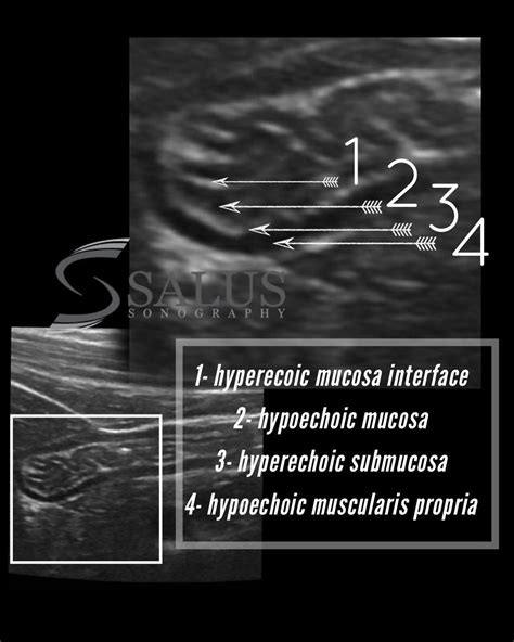 Ultrasound School Usg Ultrasound Sonography Med School Abdominal