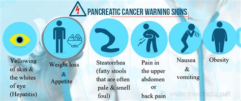 Early cancer of the pancreas may cause no symptoms. Pancreatic Cancer - All the Disease, its Diagnosis and ...
