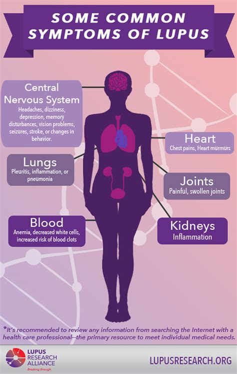 Lupus Symptoms Infographic Lupus Research