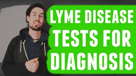 Lyme Disease Tests For Diagnosis Youtube