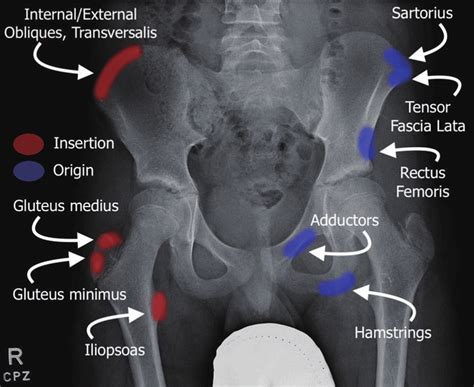 Insertion And Origins Of Common Muscles In The Pelvis Hip Region