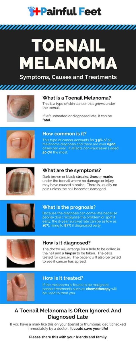 Skin cancers include melanoma, basal cell, and squamous cell. Toenail Subungal Melanoma - Symptoms, Causes and Treatments