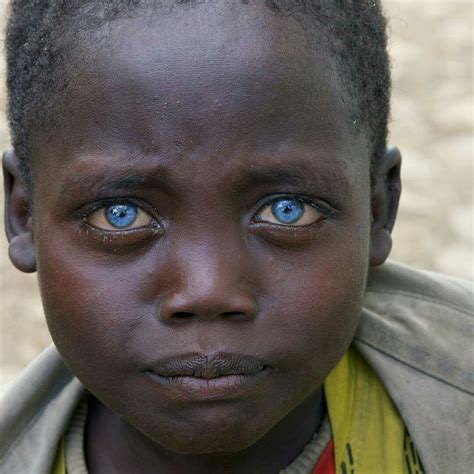 Ethiopia Child Eyes Photo By © Ameriniedoardo Gorgeous Eyes