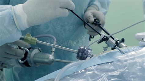 Laparoscopic Surgery Of The Abdomen Stock Photo Image Of Procedure