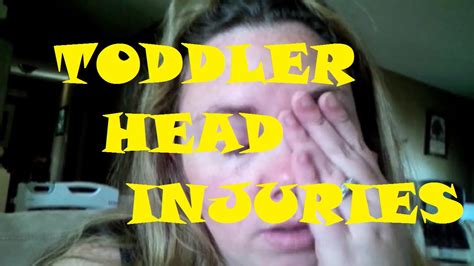 Toddler Head Injuries Day 121 Youtube