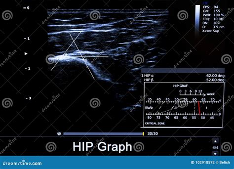 Colourful Image Of Modern Ultrasound Monitor Stock Photo Image Of