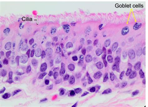 Air Conduction Nasal Cavity Paranasal Sinuses And Vomeronasal Organ