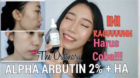 Alpha arbutin is extremely sensitive to degradation in the presence of water if the ph of the formulation is not ideal. The Ordinary Alpha Arbutin 2% + HA Review BAHASA Novie ...