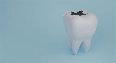 Caries dentaires causes symptômes et traitements