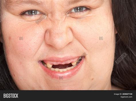 Ugly Woman Missing Image Photo Free Trial Bigstock