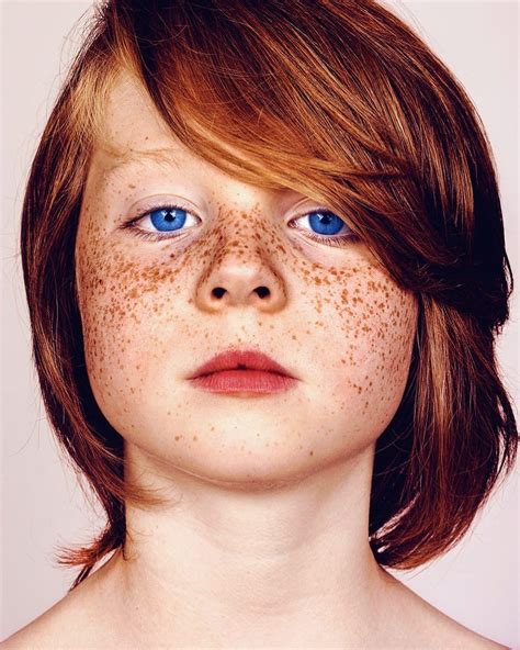 Stunning Beauty Photography Of Freckled Individuals By Brock Elbank