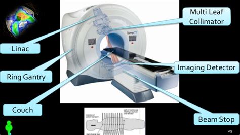 Image Guided Radiation Therapy — Matlab Number One