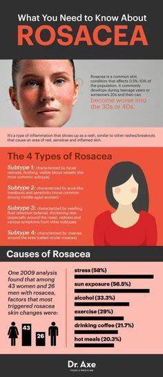 9 Best Rosacea Images Rosacea Rosacea Skin Care Rosacea Remedies
